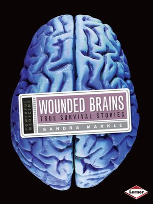 cover image of Wounded Brains